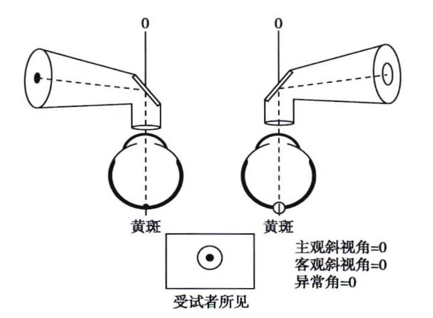 泰安验光师培训双眼单视功能