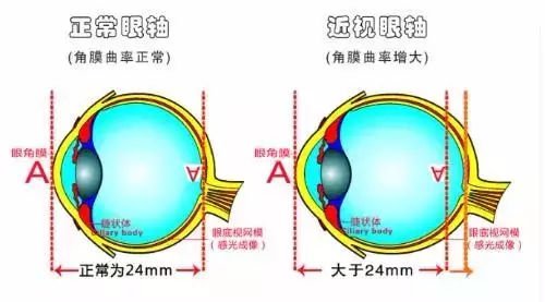 验光师培训学校，正真视光学院