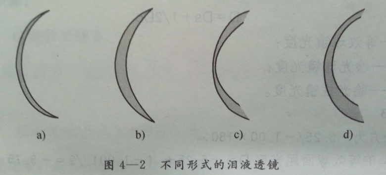 威海验光学校讲述角膜接触镜的泪液透镜分类