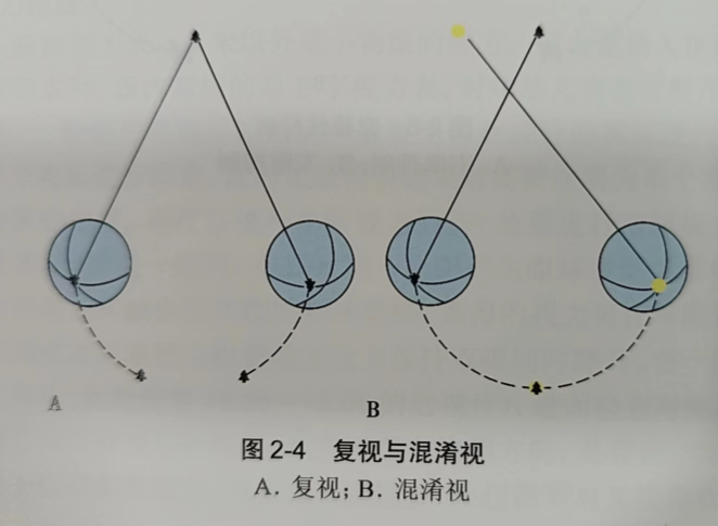 烟台验光配镜培训学校分享异常双眼视觉