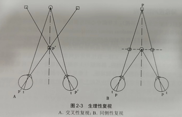 烟台验光配镜培训学校的老师分享生理性复视