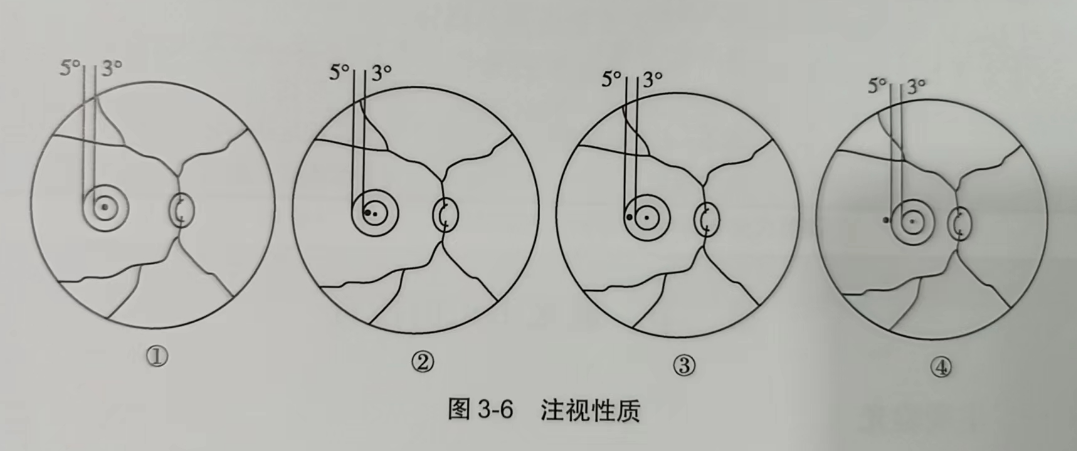 威海验光师培训的老师分享注视性质的检查