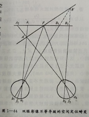 日照眼镜培训学校分享双眼影像不等的临床表现