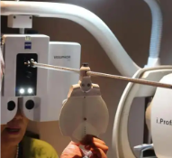 什么是垂直斜视？上斜肌麻痹的病因是什么？烟台验光师培训学校来分享